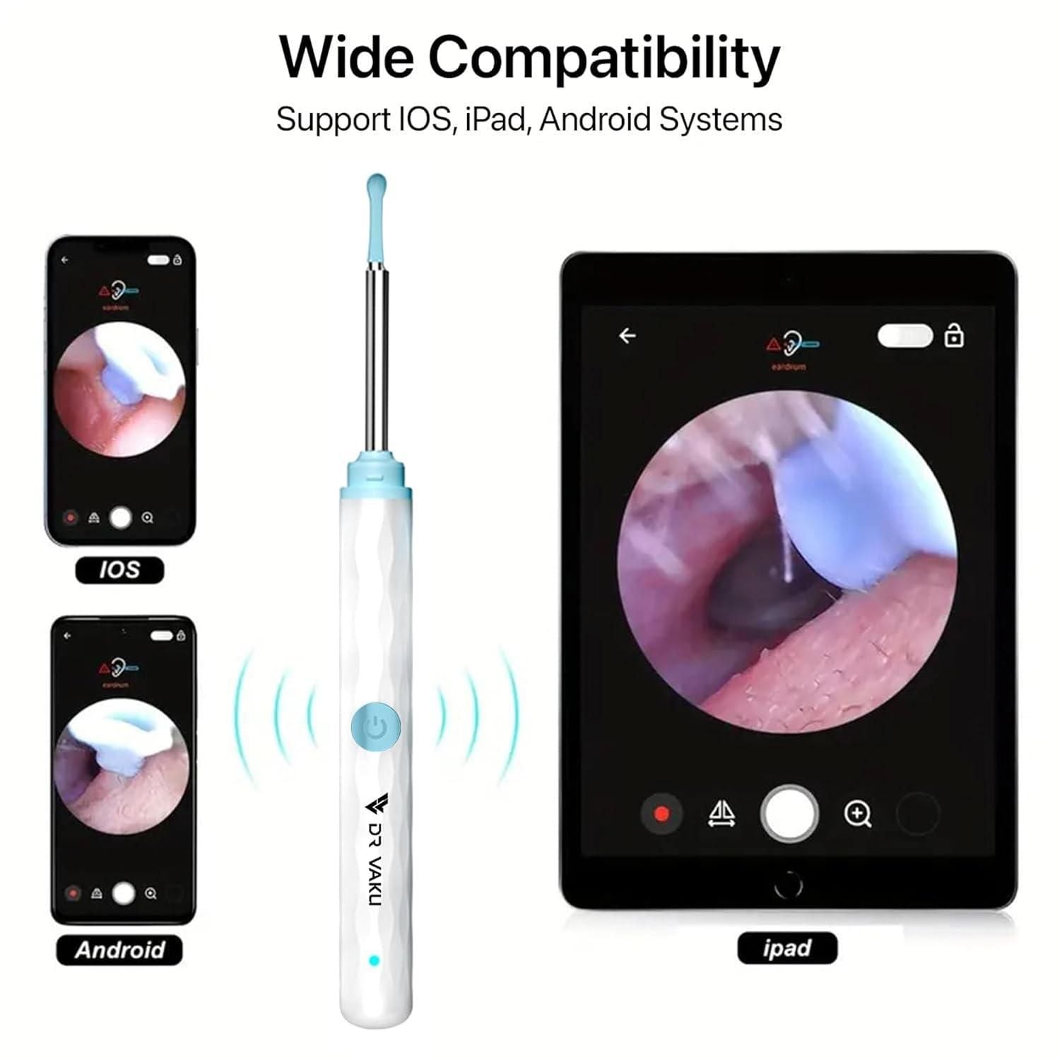 Smart Visual Ear Wax Remover – Wireless Ear Cleaner with HD Camera for iOS & Android Devices Vallinex Ventures