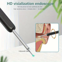 Smart Visual Ear Wax Remover – Wireless Ear Cleaner with HD Camera for iOS & Android Devices Vallinex Ventures