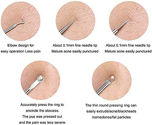 Blackhead Remover Tool Set – Stainless Steel Acne Extractor Kit for Pimple Removal (4 Pcs) Vallinex Ventures