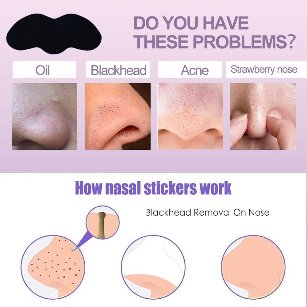 Blackhead Remover Nose Strips – Charcoal Pore Cleansing Strips for Face Care (Pack of 20) Vallinex Ventures