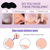Blackhead Remover Nose Strips – Charcoal Pore Cleansing Strips for Face Care (Pack of 20) Vallinex Ventures