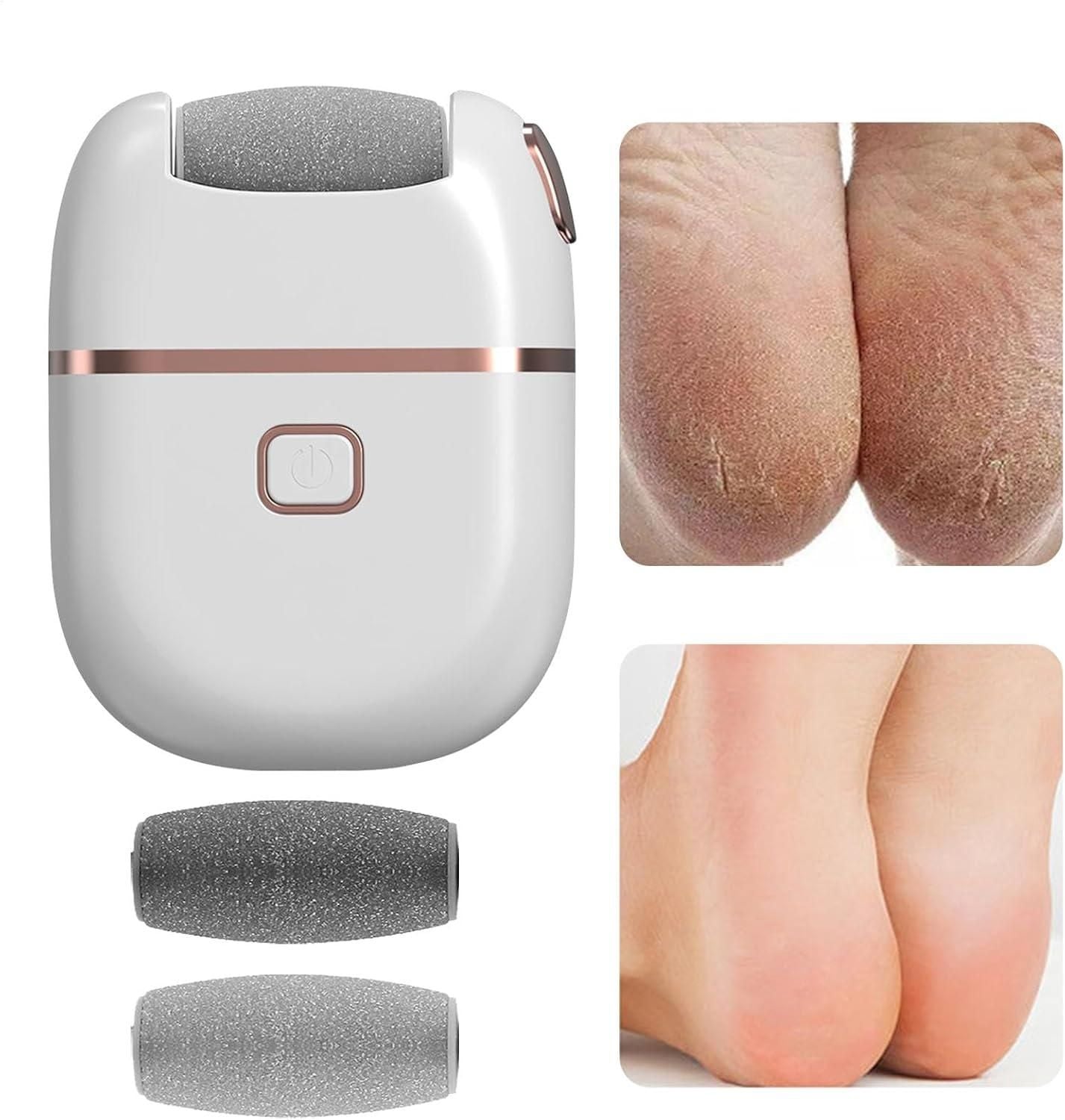 Electric Pedicure Foot File – Rechargeable Callus Remover for Smooth Feet & Soft Skin Vallinex Ventures