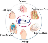 Bunion Splint Corrector – Orthopedic Toe Separator & Foot Brace for Hallux Valgus Relief (Pair) Vallinex Ventures