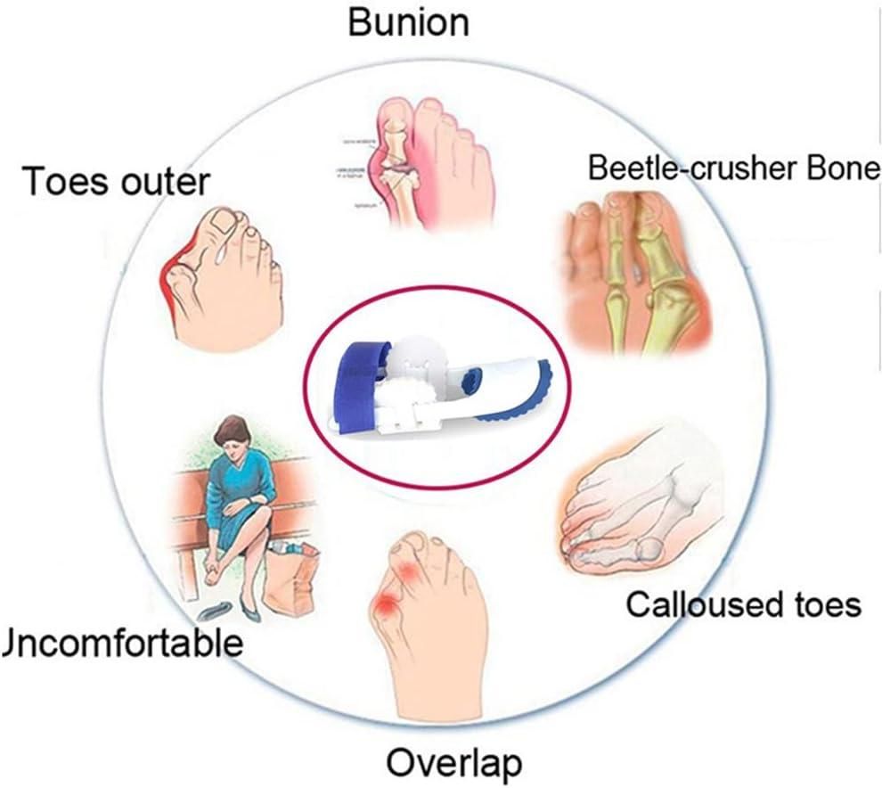 Bunion Splint Corrector – Orthopedic Toe Separator & Foot Brace for Hallux Valgus Relief (Pair) Vallinex Ventures