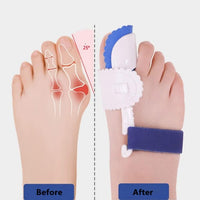 Bunion Splint Corrector – Orthopedic Toe Separator & Foot Brace for Hallux Valgus Relief (Pair) Vallinex Ventures