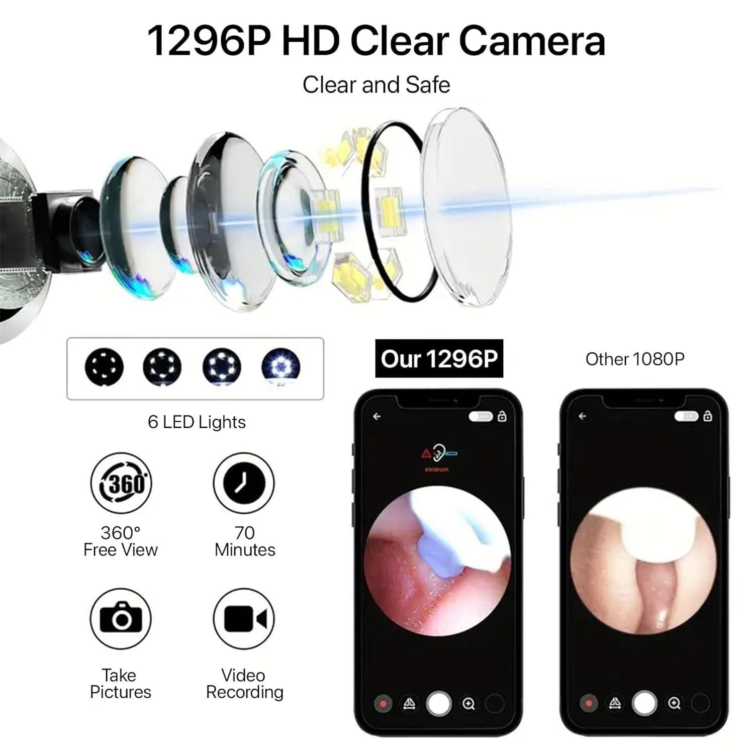 Smart Visual Ear Wax Remover – Wireless Ear Cleaner with HD Camera for iOS & Android Devices Vallinex Ventures
