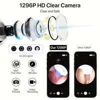 Smart Visual Ear Wax Remover – Wireless Ear Cleaner with HD Camera for iOS & Android Devices Vallinex Ventures