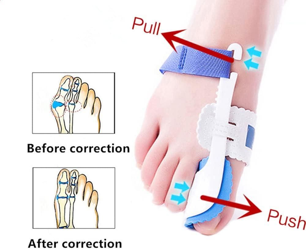 Bunion Splint Corrector – Orthopedic Toe Separator & Foot Brace for Hallux Valgus Relief (Pair) Vallinex Ventures