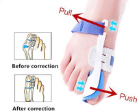 Bunion Splint Corrector – Orthopedic Toe Separator & Foot Brace for Hallux Valgus Relief (Pair) Vallinex Ventures