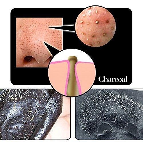 Blackhead Remover Nose Strips – Charcoal Pore Cleansing Strips for Face Care (Pack of 20) Vallinex Ventures