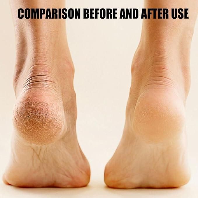 Electric Pedicure Foot File – Rechargeable Callus Remover for Smooth Feet & Soft Skin Vallinex Ventures