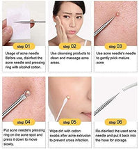 Blackhead Remover Tool Set – Stainless Steel Acne Extractor Kit for Pimple Removal (4 Pcs) Vallinex Ventures