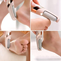 Cordless Pedicure Callus Remover – Electronic Foot Care Tool for Smooth & Healthy Skin Vallinex Ventures