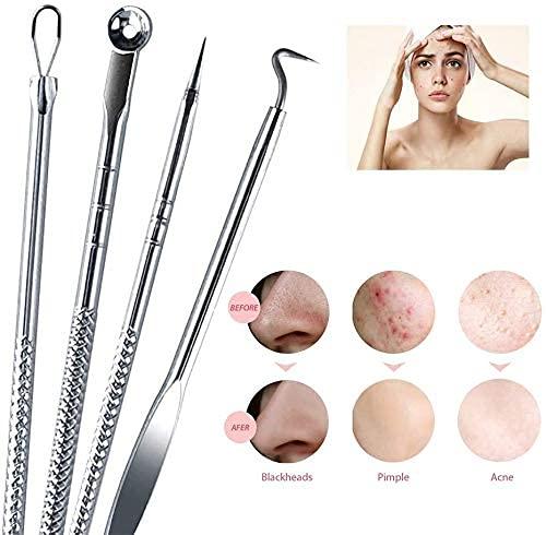Blackhead Remover Tool Set – Stainless Steel Acne Extractor Kit for Pimple Removal (4 Pcs) Vallinex Ventures